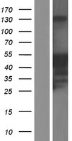 JSRP1 Human Over-expression Lysate