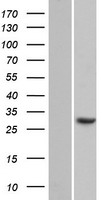 CCDC43 Human Over-expression Lysate