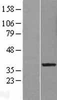 LRRC28 Human Over-expression Lysate