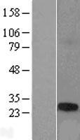 TCP10L Human Over-expression Lysate