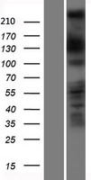 DOCK11 Human Over-expression Lysate