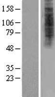 HDX Human Over-expression Lysate