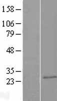 CAPSL Human Over-expression Lysate