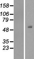 TEKT4 Human Over-expression Lysate