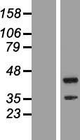 TTC23L Human Over-expression Lysate