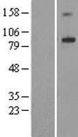 ADAM32 Human Over-expression Lysate