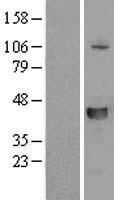 SLFNL1 Human Over-expression Lysate