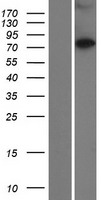 CCDC138 Human Over-expression Lysate