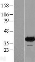 DENND1B Human Over-expression Lysate