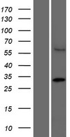 CCDC122 Human Over-expression Lysate