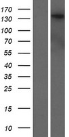 DENND5B Human Over-expression Lysate