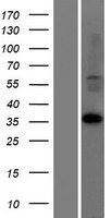 LDHAL6A Human Over-expression Lysate