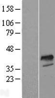 FOXI1 Human Over-expression Lysate