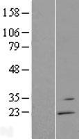 RGS13 Human Over-expression Lysate