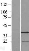 RG9MTD3 (TRMT10B) Human Over-expression Lysate