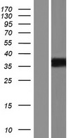PRSS21 Human Over-expression Lysate
