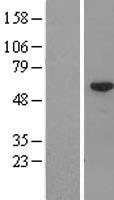 CCDC11 (CFAP53) Human Over-expression Lysate
