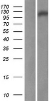 C11orf82 (DDIAS) Human Over-expression Lysate