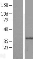 HYLS1 Human Over-expression Lysate