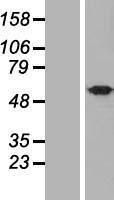 UBQLNL Human Over-expression Lysate