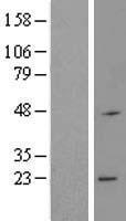 RNF183 Human Over-expression Lysate