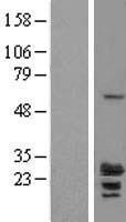 RILPL2 Human Over-expression Lysate