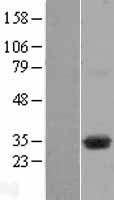 DHRSX Human Over-expression Lysate
