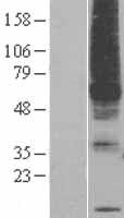 PIGM Human Over-expression Lysate