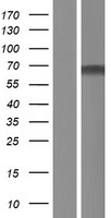 ZNF498 (ZSCAN25) Human Over-expression Lysate