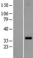 Repulsive Guidance Molecule C (HFE2) Human Over-expression Lysate