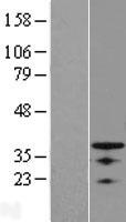 OSR1 Human Over-expression Lysate