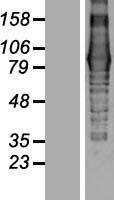 EVI5L Human Over-expression Lysate