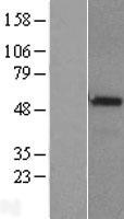 CHRDL1 Human Over-expression Lysate