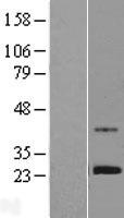 ZNF625 Human Over-expression Lysate