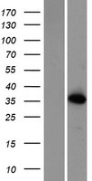 ATPBD3 (CTU1) Human Over-expression Lysate