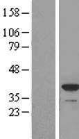 Apolipoprotein L 2 (APOL2) Human Over-expression Lysate