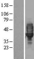 LRRC25 Human Over-expression Lysate