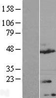 TMEM170A Human Over-expression Lysate