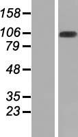 WDR67 (TBC1D31) Human Over-expression Lysate