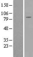 DGKB Human Over-expression Lysate