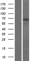 DBF4B Human Over-expression Lysate