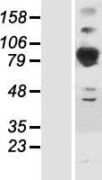 SEPTIN6 Human Over-expression Lysate