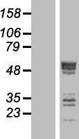 SEPTIN6 Human Over-expression Lysate