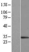 Microsomal Glutathione S transferase 1 (MGST1) Human Over-expression Lysate
