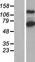 ARHGEF7 Human Over-expression Lysate