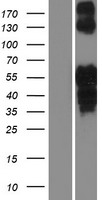 Islet 2 (ISL2) Human Over-expression Lysate