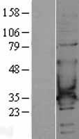 CACNG6 Human Over-expression Lysate