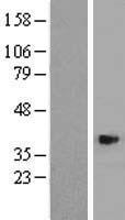 ASB4 Human Over-expression Lysate