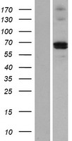 MMP21 Human Over-expression Lysate