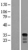 PIG3 (TP53I3) Human Over-expression Lysate
